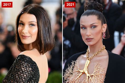 Sneaky plastic surgeries used by celebs to look better than you